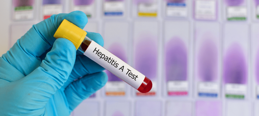 Hepatitis A Wellingborough